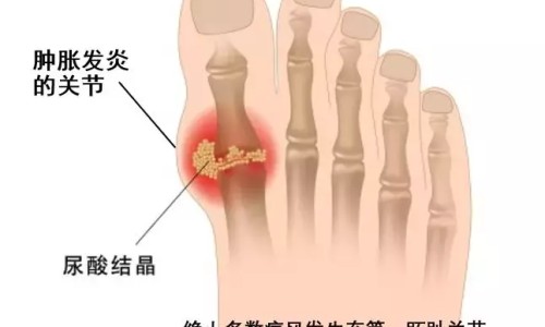 淋病治疗期间能吃辛辣食物吗-淋病治疗期间能吃辛辣食物吗网 - 为你提供淋病期间吃辣会有什么后果、淋病治疗期间能吃辛辣食物吗